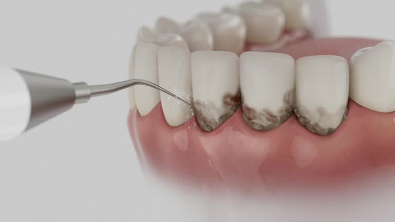 Reliable Dental Implants contractor in Hayti, MO by Smile Center Dentistry